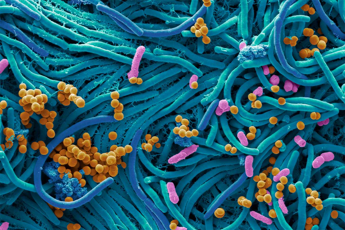 microbiota intestino batteri